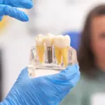 Dental Crowns and Bridges