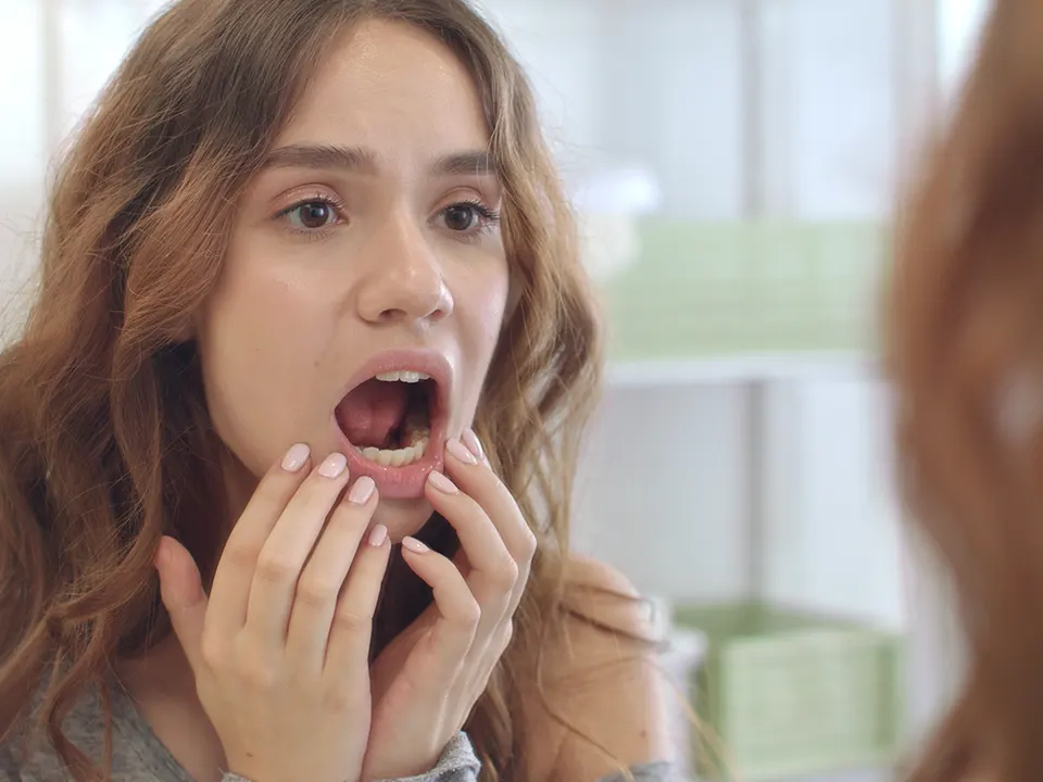 White Spots on Teeth